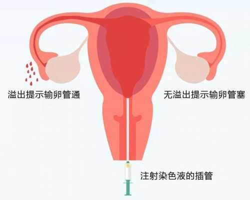 上海供卵试管助孕中介,上海供卵试管中介c_上海正规供卵试管婴儿医院