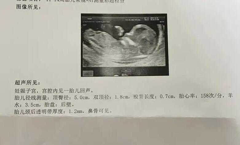  上海代妈助孕流程-上海代妈托管公司